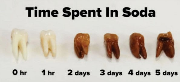 Sugar does NOT rot your teeth